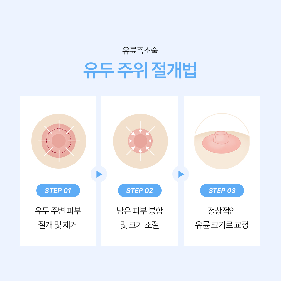 Why Areola Size Correction Should Consider Breast Proportions image 4