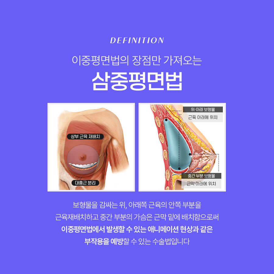 가슴확대수술방법 종류별 특징은? 관련 이미지 6