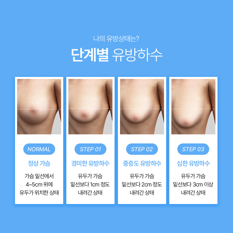 Breast Lift Surgery: Understanding the Causes of Sagging and Surgical Methods image 4