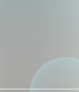 If you’re wondering which implant is best for Motiva breast augmentation image 26