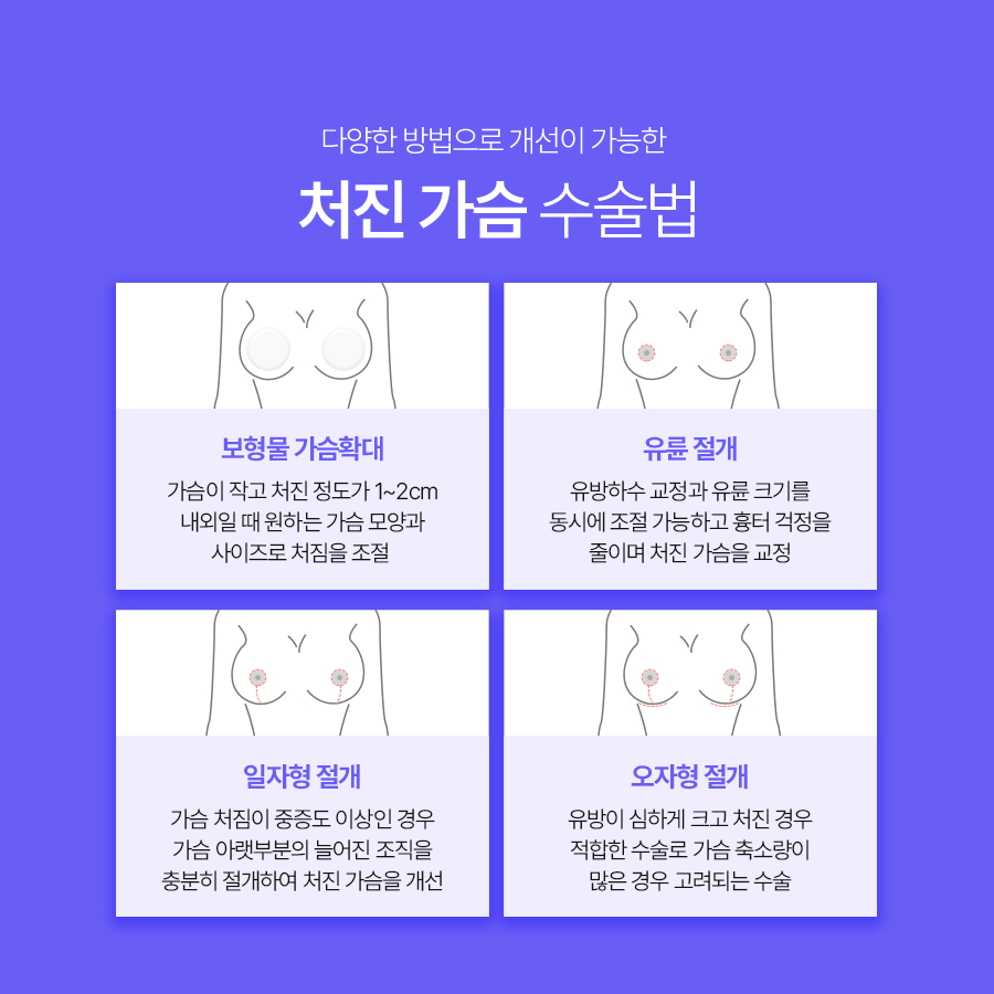 처진가슴수술비용, 처짐 정도에 따른 교정방법 관련 이미지 6