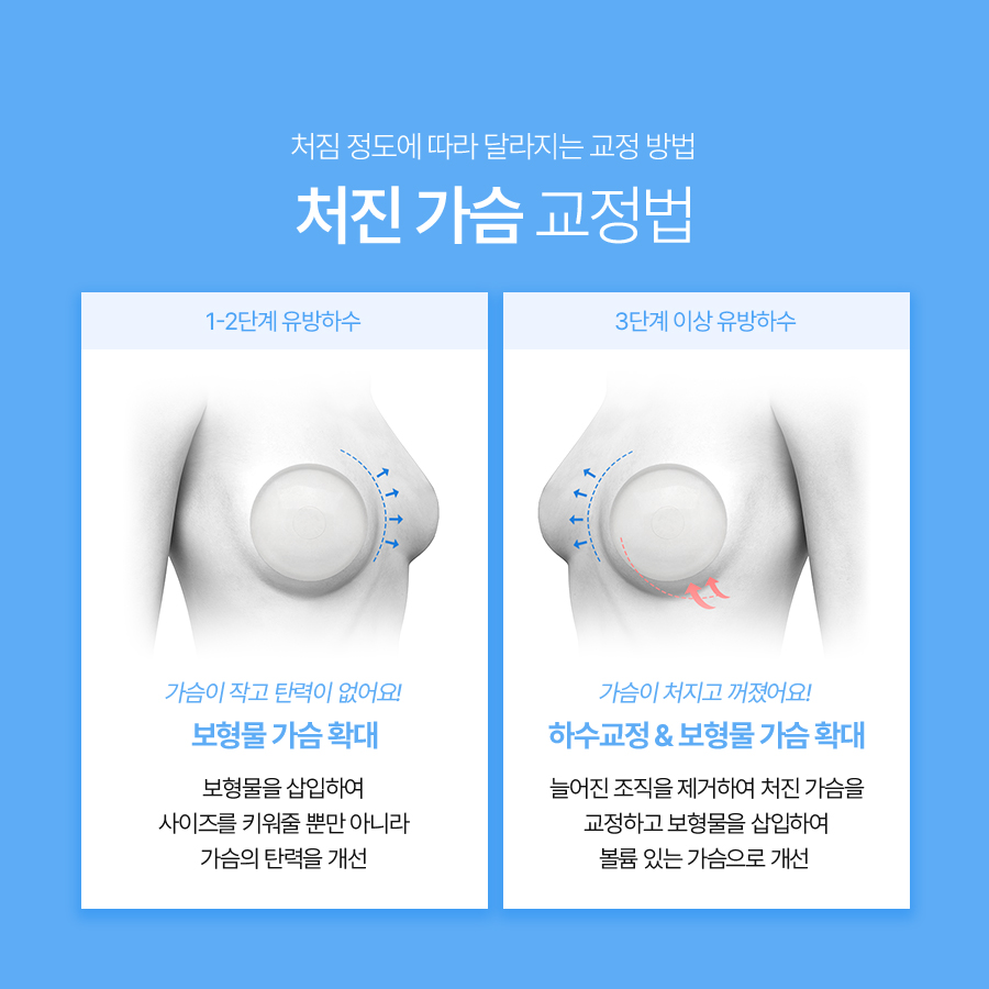 Breast Lift Surgery: Understanding the Causes of Sagging and Surgical Methods image 5