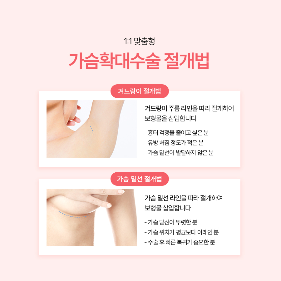 Triple-Plane Breast Augmentation: What Is the Key to Higher Satisfaction? image 6