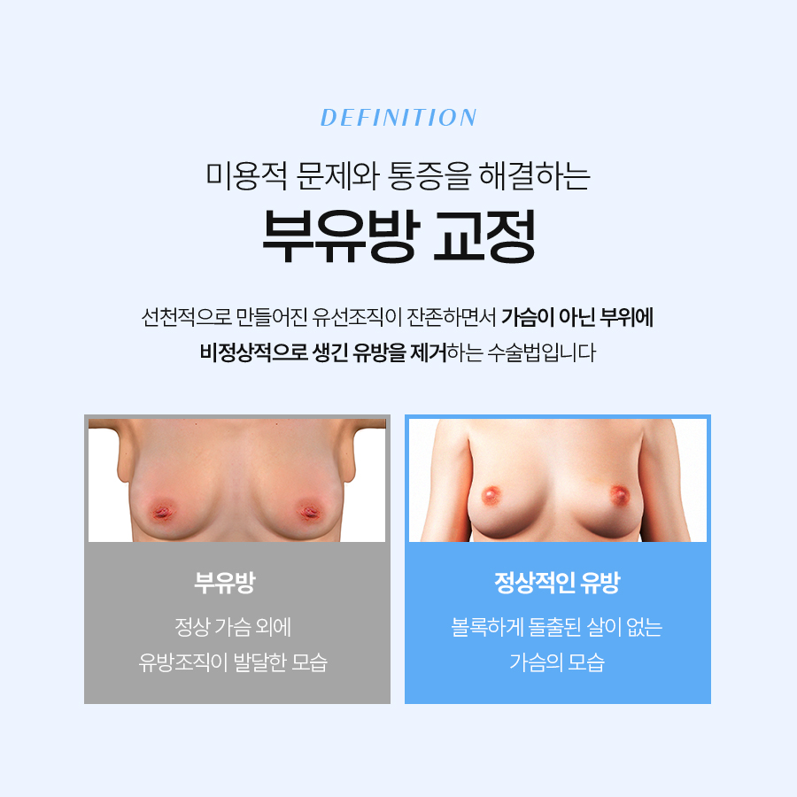 뷰유방 지방제거 라인 정리가 중요한 이유 관련 이미지 5