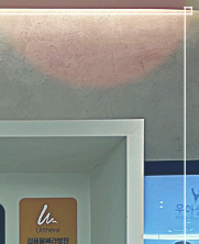 Accessory Breast Fat Removal: A Look at Accessory Breast Correction Considering Upper-Body Proportions image 12