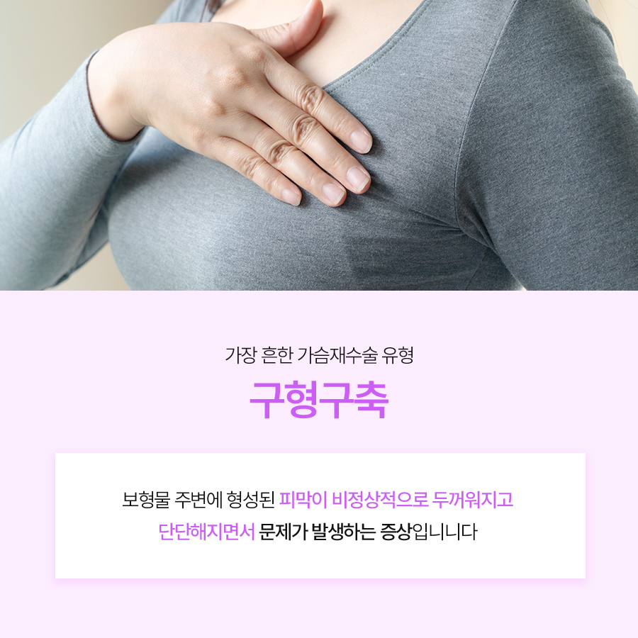 Why You Should Have Capsular Contracture Capsule Removal Performed at a Specialized Clinic image 3