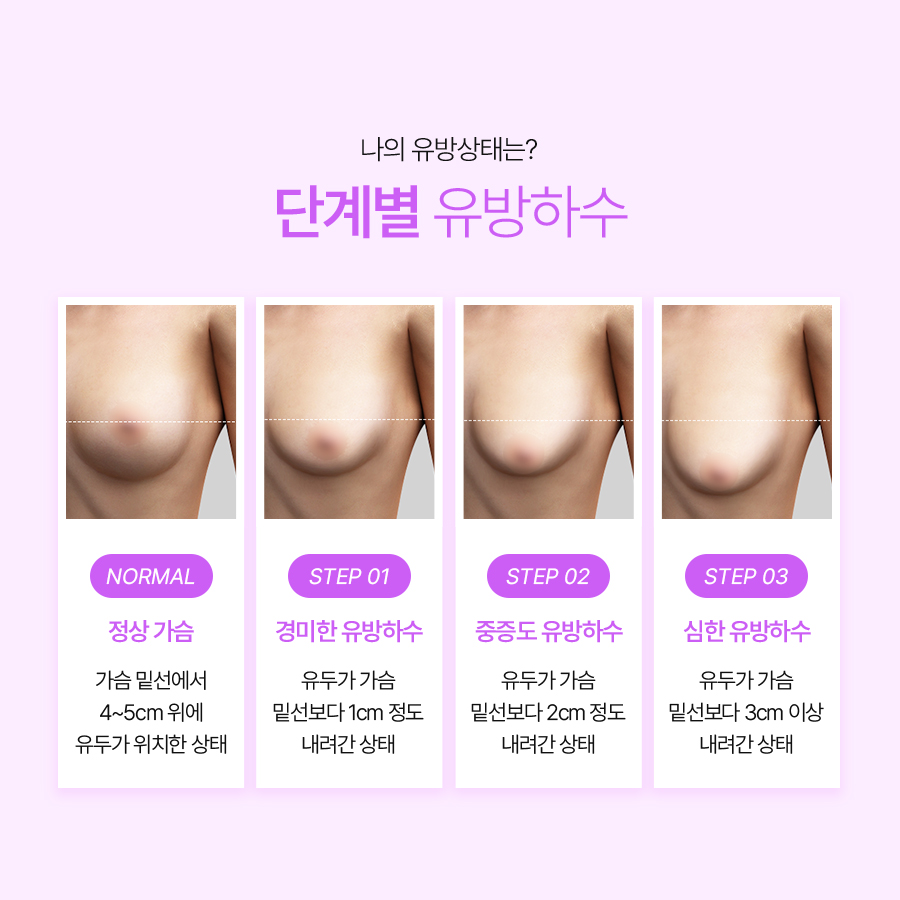 중년가슴성형 처진 가슴 개선으로 되찾는 상체 라인 관련 이미지 4