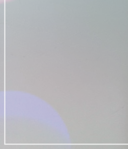 If you’re wondering which implant is best for Motiva breast augmentation image 25