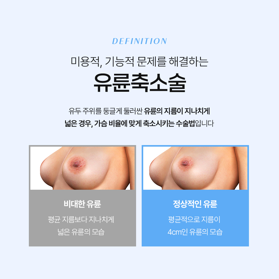 가슴유륜축소수술 꼭 알아야 할 모든 것 관련 이미지 3