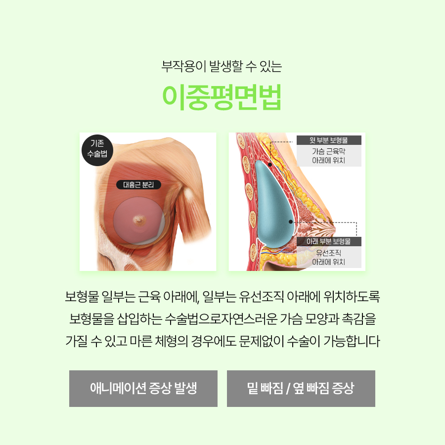 Breast Revision Surgery Timing: Why Is Everyone Looking for the Triple-Plane Technique? image 3
