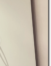 Recommended Breast Revision Surgery Clinics: Why the Triple-Plane Technique Is Drawing Attention image 15