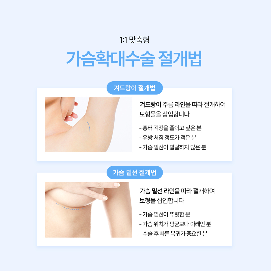 Three-Plane Breast Augmentation: Natural-Looking Breasts Begin with Planning image 6