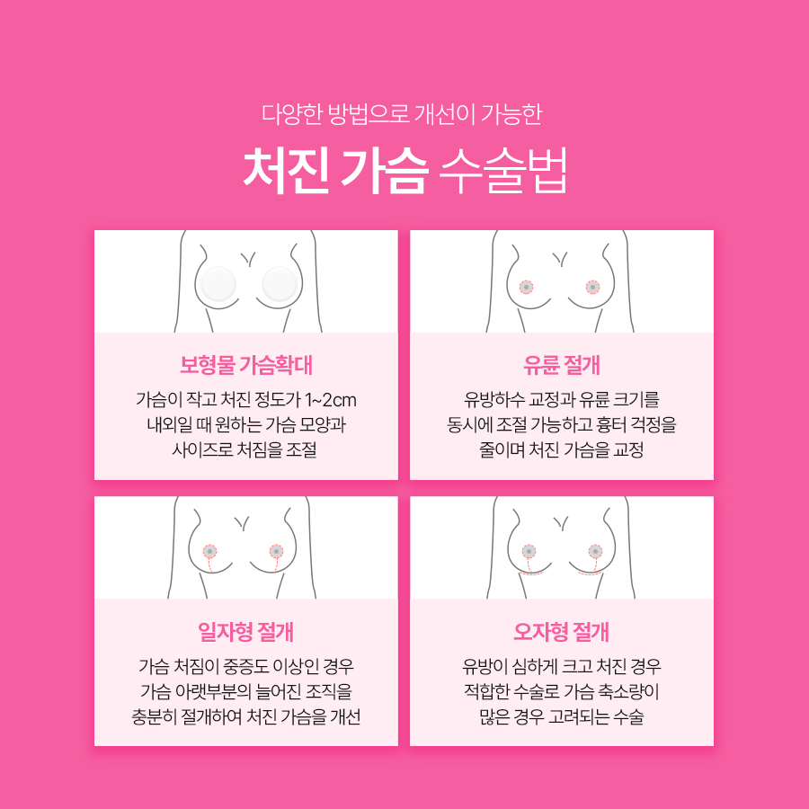 Breast Sagging Correction Surgery: Correction Methods Based on the Degree of Breast Ptosis image 6