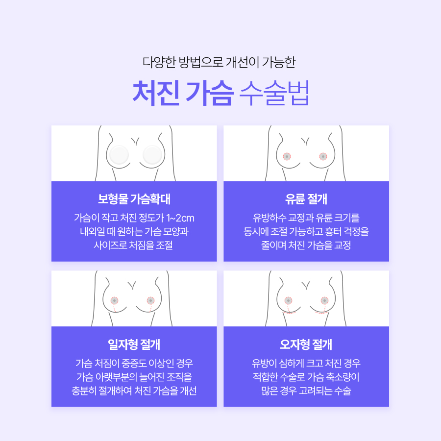 처진가슴보형물수술 체형 균형을 고려한 방법 관련 이미지 6