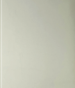 Mentor Boost Breast Augmentation: Preserving Volume While Providing a Softer Feel image 13