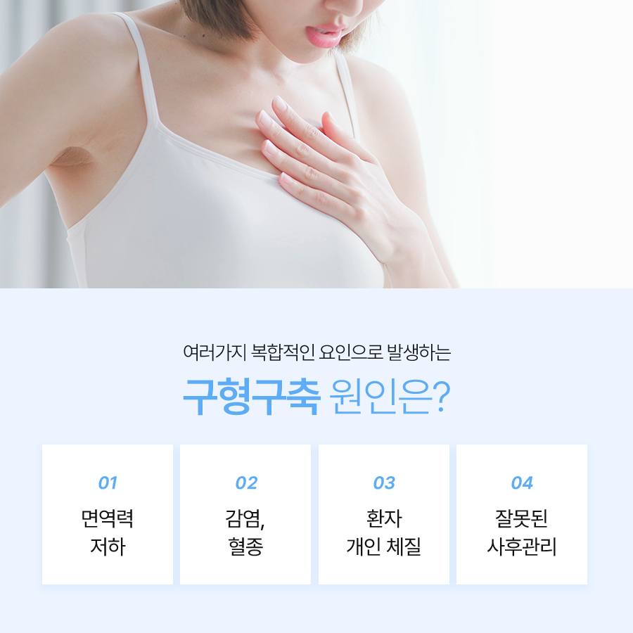 구형구축가슴재수술, 필요한 경우와 수술 방법은? 관련 이미지 4