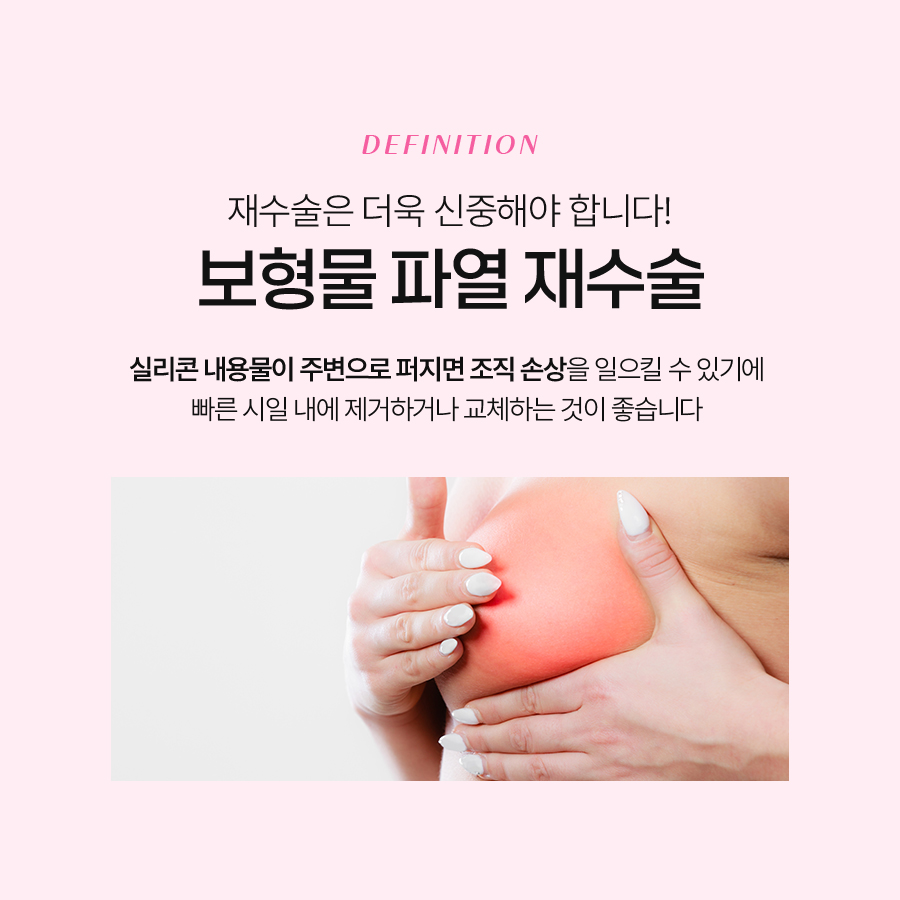 Why Revision Surgery Through an Armpit Incision Is Possible in the Event of Breast Implant Rupture image 5