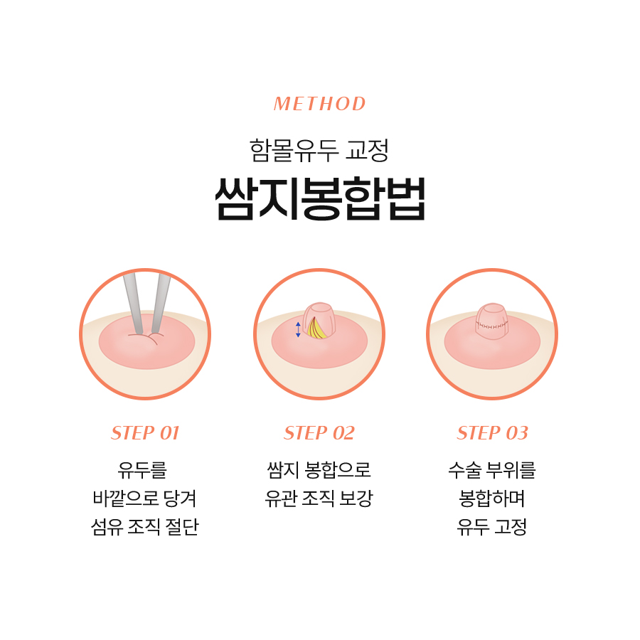 여성함몰유두교정, 원인에 따른 교정 방법 관련 이미지 5