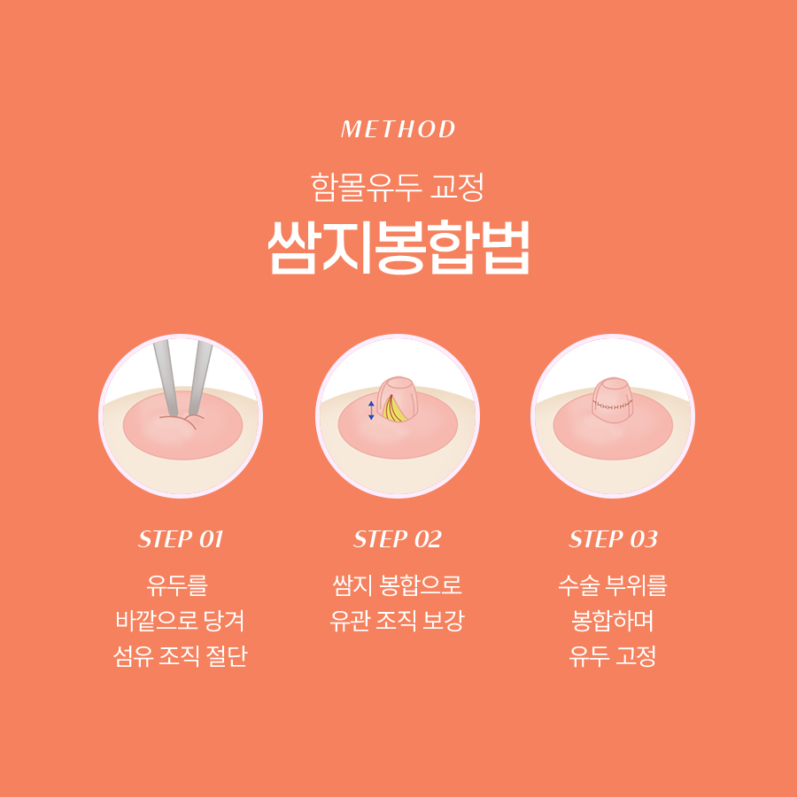 함몰유두교정수술 어떻게 진행될까? 관련 이미지 5