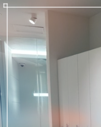 함몰유두교정술 적합한 수술방법은? 관련 이미지 18