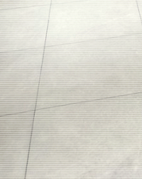 Breast Sagging Correction Surgery: Correction Methods Based on the Degree of Breast Ptosis image 25