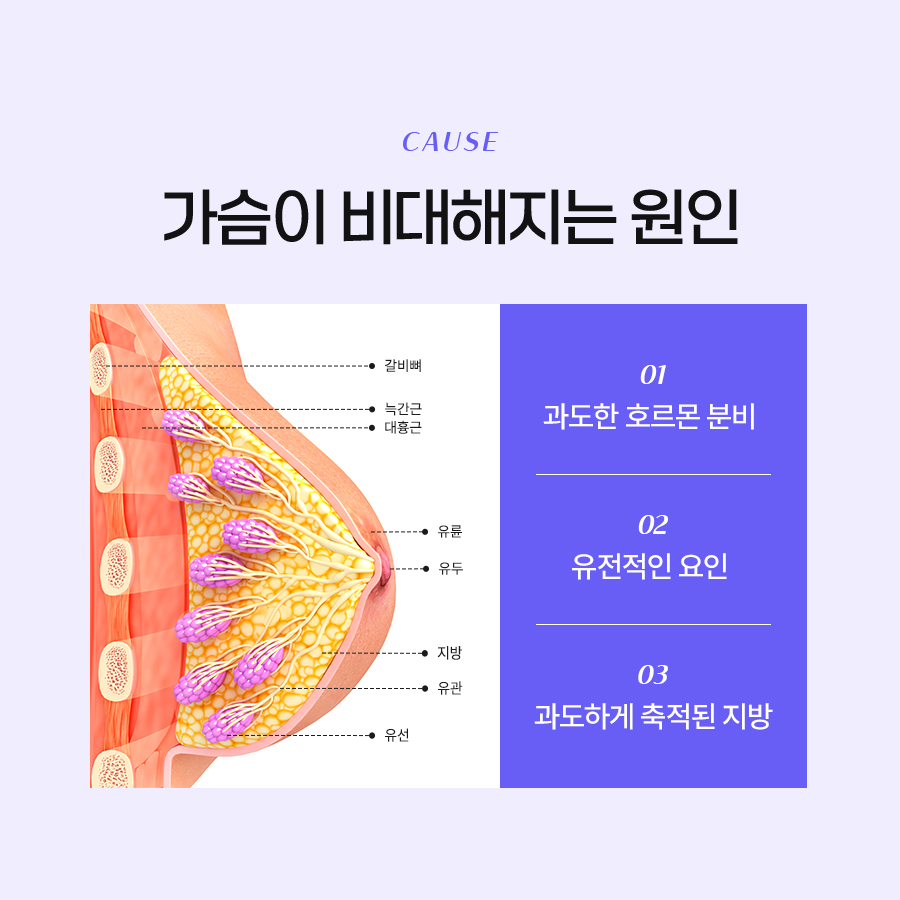 거대유방증수술 꼭 알아야 할 핵심 정보 관련 이미지 3