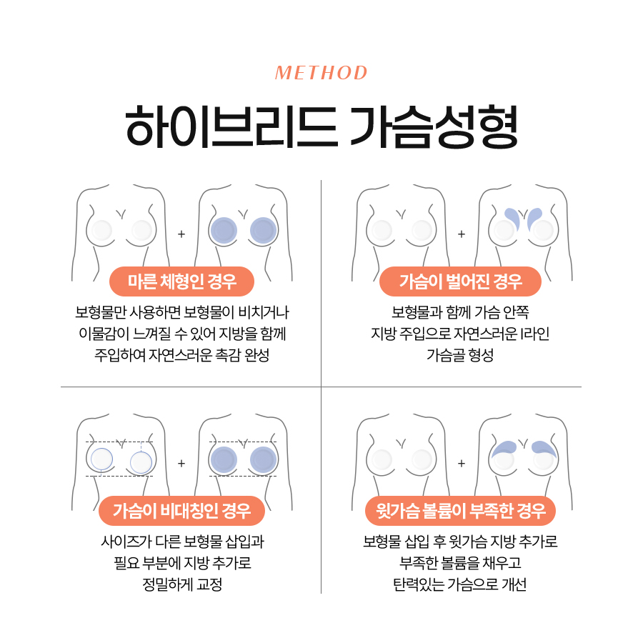 Hybrid Breast Surgery: A More Natural and Effective Change image 5