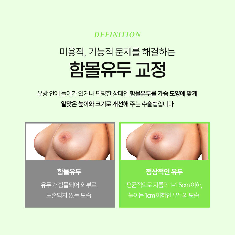 여성함몰유두교정, 다시 함몰되지 않으려면 확인해야 할 부분 관련 이미지 3