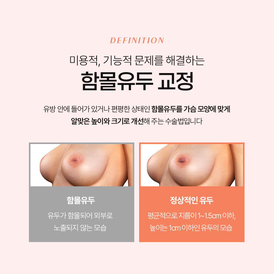 함몰유두 교정법, 어떤 수술이 나에게 맞을까? 관련 이미지 4