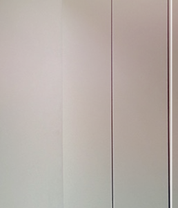 Hybrid Breast Augmentation Method: Volume and Shape at the Same Time image 15