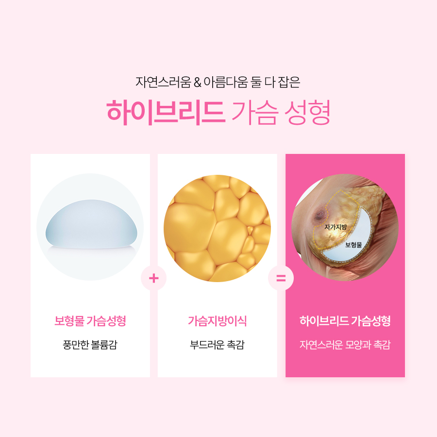 가슴지방이식수술 아름다운 라인, 이상적인 볼륨감 관련 이미지 4