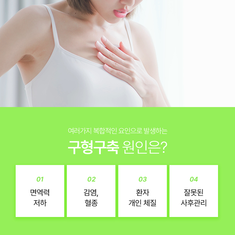 가슴구형구축재수술, 개인별 원인에 맞춘 계획이 중요한 이유 관련 이미지 5