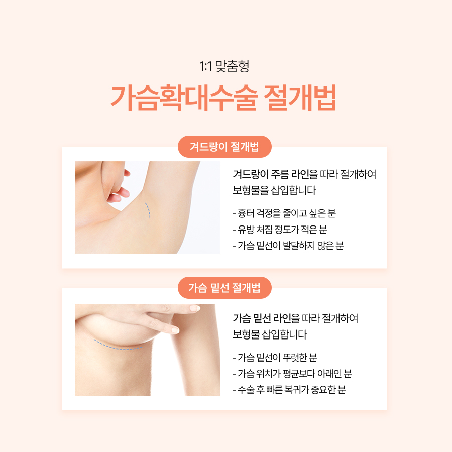 가슴재수술방법 삼중평면으로 달라지는 결과 관련 이미지 6
