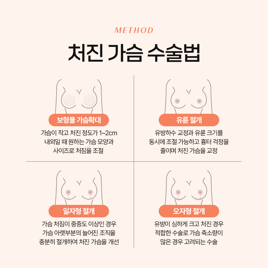 유방하수 교정수술, 언제 필요하고 어떻게 진행될까? 관련 이미지 6