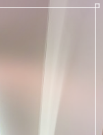 보형물가슴성형 자연스러운 라인 만드는 방법 관련 이미지 21