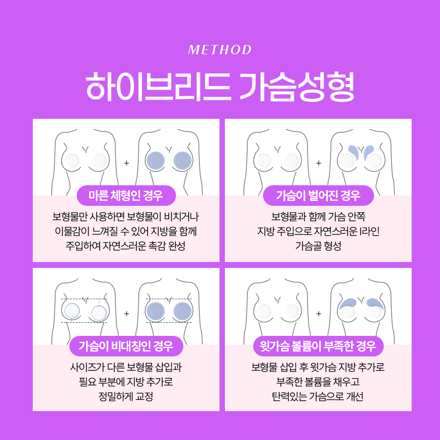 하이브리드가슴수술 일반 가슴성형과 뭐가 다를까? 관련 이미지 6
