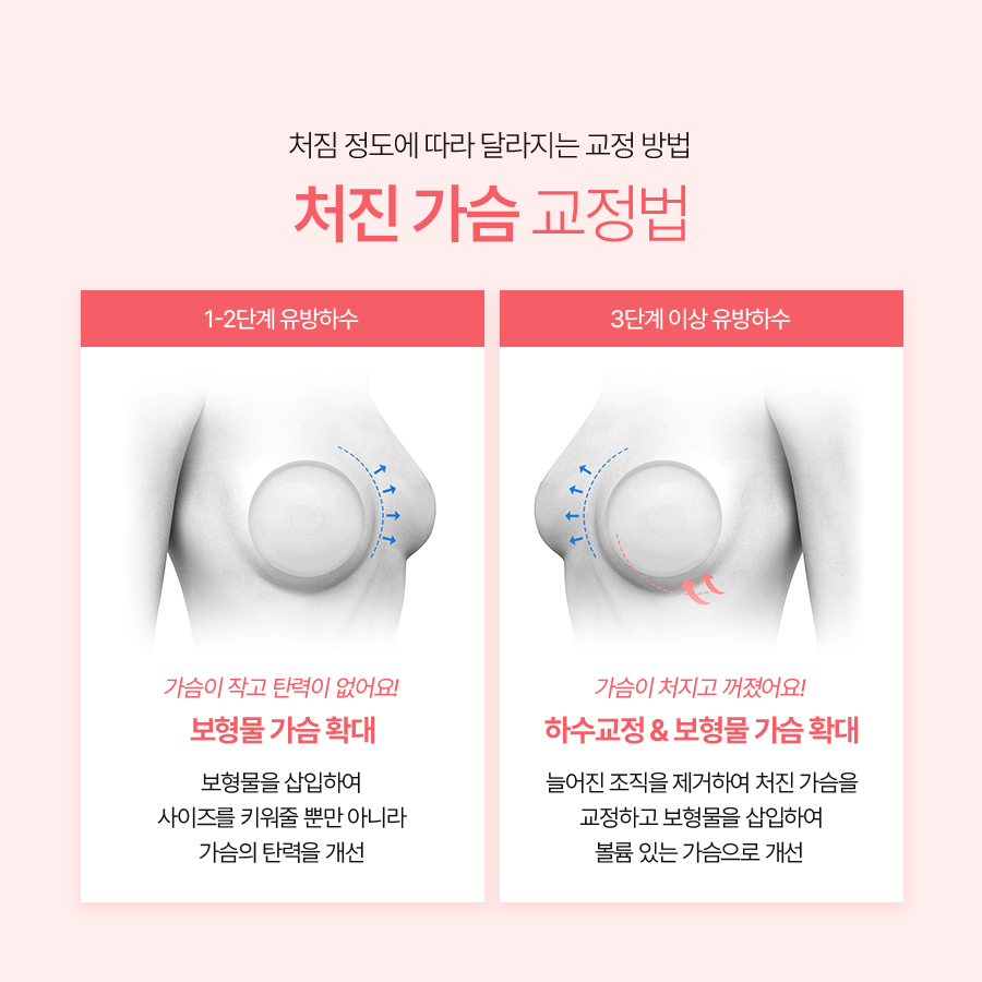 유방하수수술 후기 부유방까지 함께 본 이유 관련 이미지 5