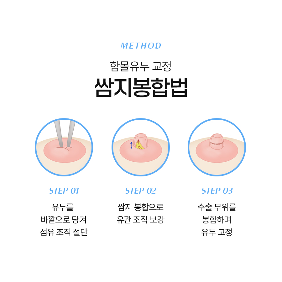 Could the timing of inverted nipple surgery costs also be important? image 5
