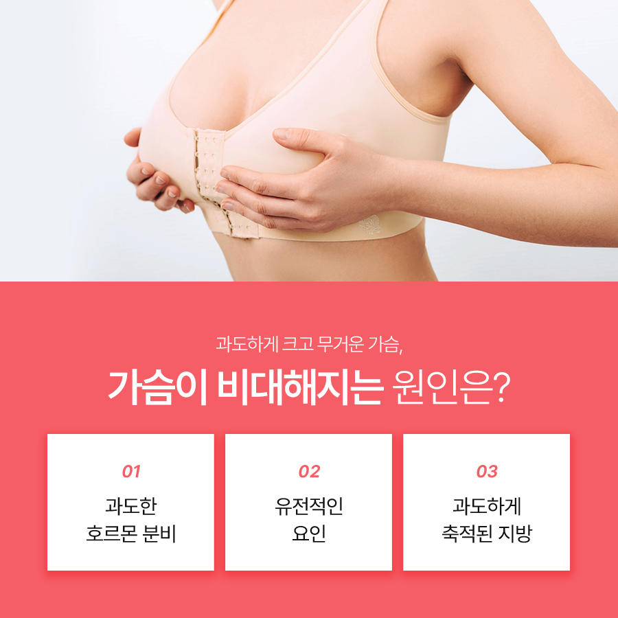 가슴축소성형외과, 가슴이 커지는 원인과 수술 방법 관련 이미지 3