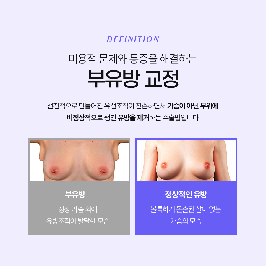 Removing Auxiliary Breast Fat to Achieve a Smooth Upper Body Line image 4