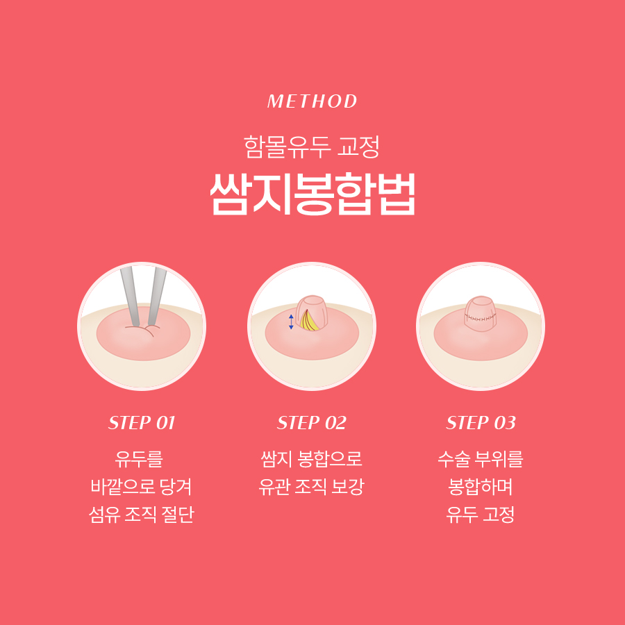 함몰유두교정수술 만족도 높은 이유 관련 이미지 5