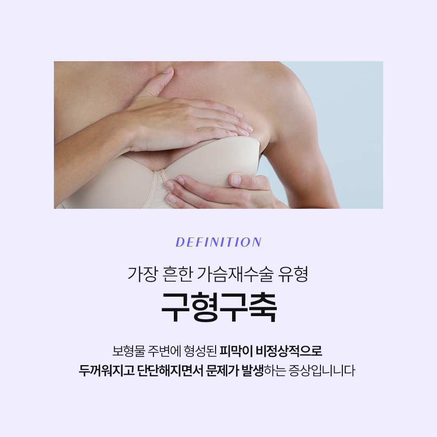 가슴수술절개부위 선택이 중요한 재수술 관련 이미지 4