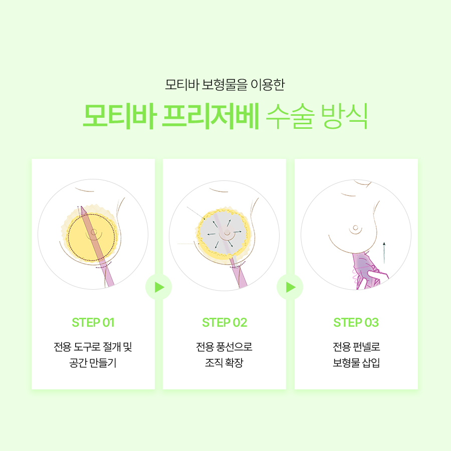 모티바프리저베 잘하는곳, 조직 보존과 자연스러운 가슴라인의 관계 관련 이미지 4