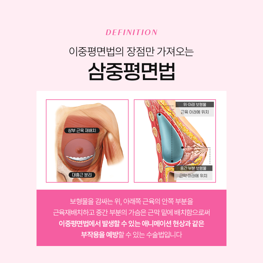 겨드랑이절개재수술 전에 꼭 알아야 할 것들 관련 이미지 5