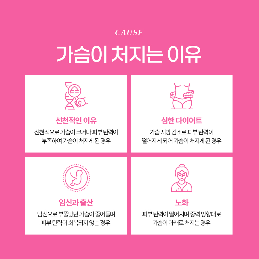 처진가슴수술비용 처짐 정도에 따라 달라지는 교정 방법 관련 이미지 3