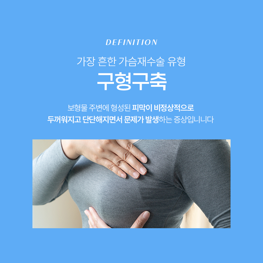 가슴구형구축원인 알고 나에게 맞는 재수술 준비하기 관련 이미지 3