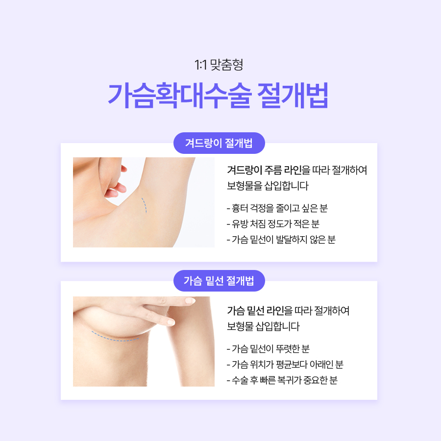 가슴수술잘하는병원 자연스러운 움직임을 고려한 가슴수술 방식 비교 관련 이미지 6