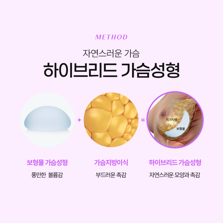 하이브리드 가슴성형 개인별 맞춤형 수술을 위한 관련 이미지 4