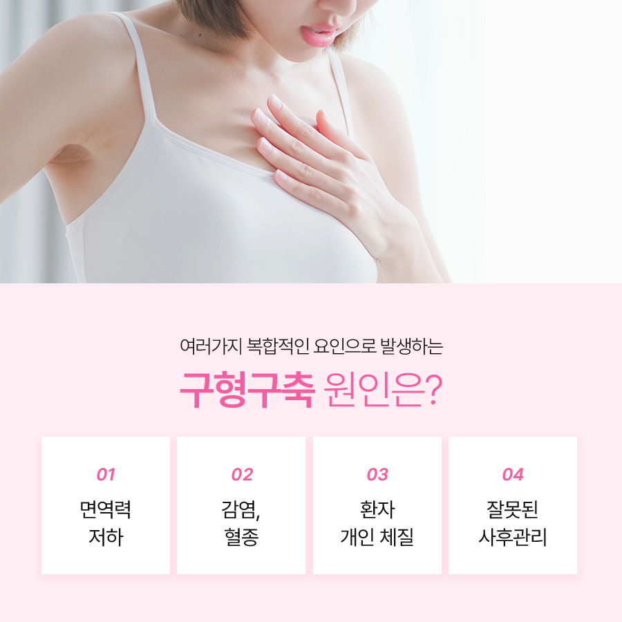 가슴성형재수술 자연스러운 교정 방향은 관련 이미지 5