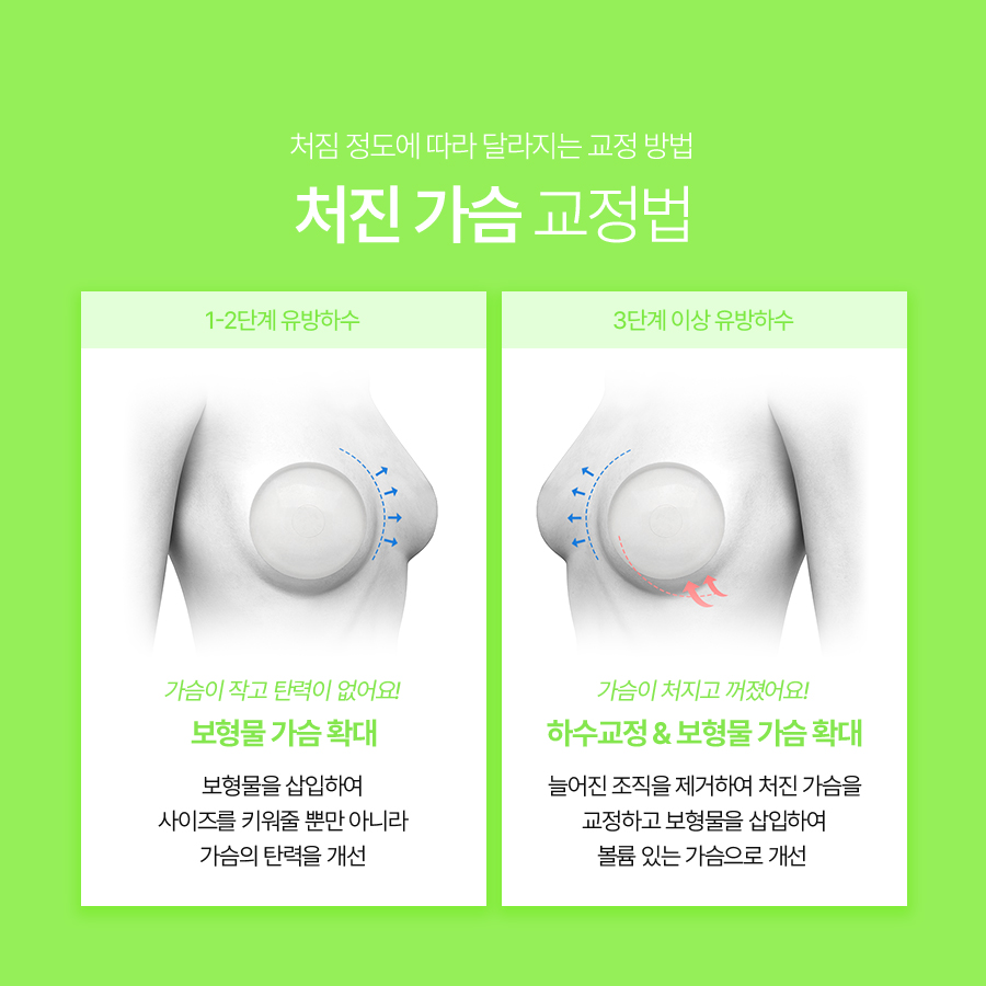 Breast Ptosis Correction Surgery: Why You Should First Examine the Causes of Sagging Breasts image 5